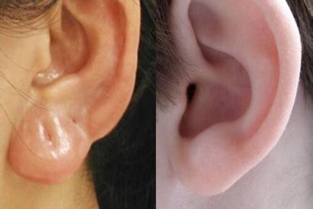 2012是什麼年 耳朵長斑